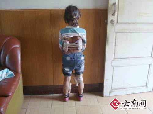 <em>女孩</em>的腰部两侧和两腿膝盖内侧查获用透明胶带